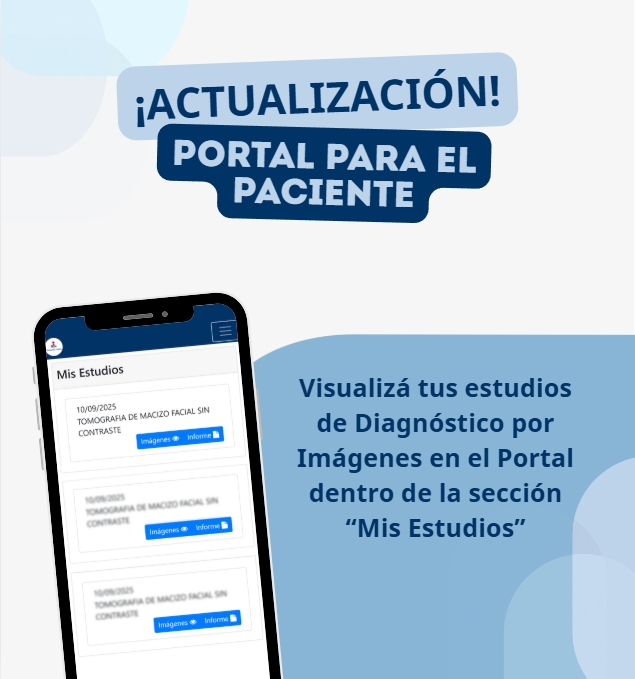 Banner de promoción sobre la actualización del portal